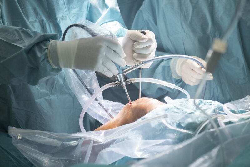 Orthopedic Surgeons Things You Need to Know Essentially Health Wise