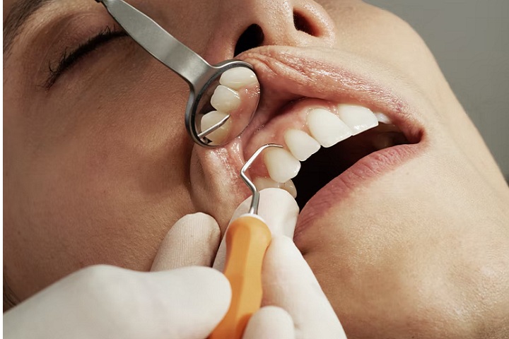 Root Canal Treatment: Saving Your Tooth and Relieving Pain